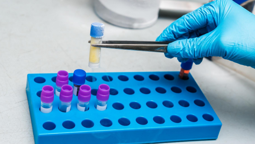 細胞凍存 細胞凍存